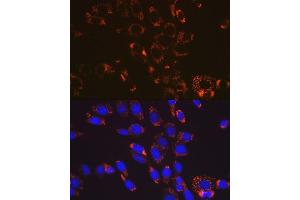Immunofluorescence analysis of NIH-3T3 cells using SOD2 antibody (ABIN7270638). (SOD2 抗体)