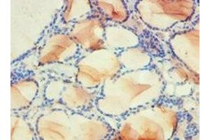 Immunohistochemistry of paraffin-embedded human thyroid tissue using ABIN7142339 at dilution of 1:100 (PDPK1 抗体  (AA 277-556))