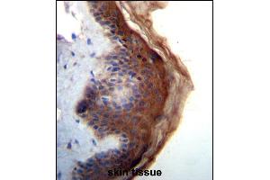 IL1F5 Antibody (N-term) (ABIN656238 and ABIN2845554) immunohistochemistry analysis in formalin fixed and paraffin embedded human skin tissue followed by peroxidase conjugation of the secondary antibody and DAB staining. (FIL1d 抗体  (N-Term))