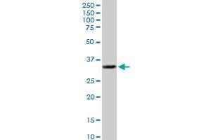 EPCAM MaxPab polyclonal antibody. (EpCAM 抗体  (AA 1-314))