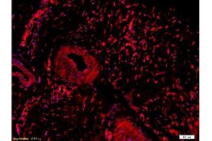 Formalin-fixed and paraffin embedded rabbit meniscus tissue labeled Anti-Collagen II Polyclonal Antibody, Unconjugated  at 1:200, followed by conjugation to the secondary Goat Anti-Rabbit IgG, Cy3 conjugated -Cy3)used at 1:200 dilution for 40 minutes at 37°C. (COL2 抗体  (AA 1201-1300))