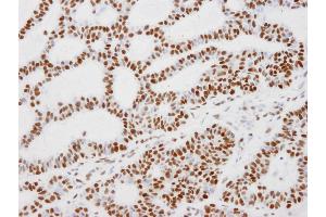 Immunohistochemistry (IHC) image for anti-Tripartite Motif Containing 28 (TRIM28) (AA 1-50) antibody (ABIN7448920)