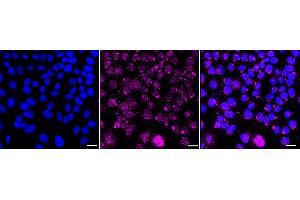 Immunocytochemical staining of HepG2 cells with HRAS antibody (ABIN7799002), 1:1,000). (Recombinant HRAS 抗体)
