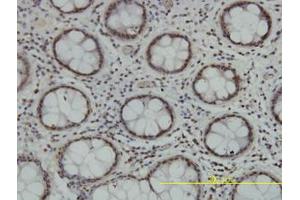 Image no. 1 for anti-Tousled-Like Kinase 2 (TLK2) (AA 1-126) antibody (ABIN599164) (TLK2 抗体  (AA 1-126))