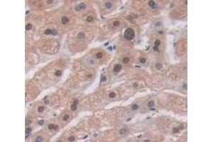 IHC-P analysis of Human Tissue, with DAB staining. (CCL1 抗体  (AA 24-96))