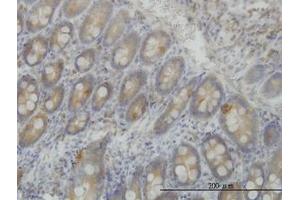 Image no. 1 for anti-Leucine Rich Repeat (In FLII) Interacting Protein 1 (LRRFIP1) (AA 675-785) antibody (ABIN465979) (LRRFIP1 抗体  (AA 675-785))