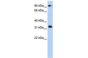Image no. 1 for anti-Coiled-Coil Domain Containing 69 (CCDC69) (C-Term) antibody (ABIN6741306) (CCDC69 抗体  (C-Term))