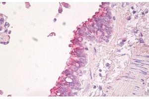 Image no. 2 for anti-Scavenger Receptor Class B, Member 2 (SCARB2) (AA 25-74) antibody (ABIN6749778) (SCARB2 抗体  (AA 25-74))