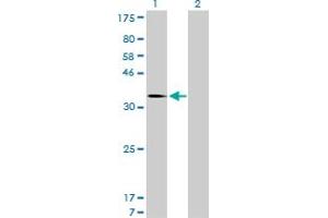 Western Blot analysis of MDM2 expression in transfected 293T cell line by MDM2 monoclonal antibody (M01), clone 1A7.