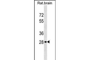Rat Hoxd9 Antibody (Center) (ABIN1537807 and ABIN2849159) western blot analysis in rat brain tissue lysates (35 μg/lane). (HOXD9 抗体  (AA 127-154))