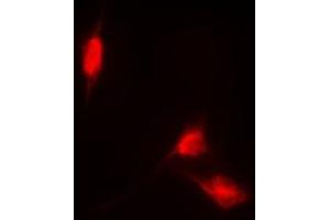 Immunofluorescent analysis of NRF2 staining in HL60 cells. (NRF2 抗体  (C-Term))