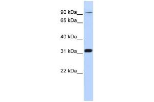 WB Suggested Anti-CNNM4 Antibody Titration:  0. (CNNM4 抗体  (Middle Region))