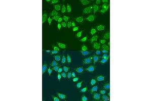 Immunofluorescence analysis of U2OS cells using L2HGDH antibody (ABIN7268160) at dilution of 1:100. (L2HGDH 抗体  (AA 1-220))