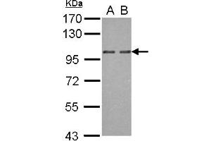 Western Blotting (WB) image for anti-Oxysterol Binding Protein 2 (OSBP2) (AA 596-835) antibody (ABIN1499917) (OSBP2 抗体  (AA 596-835))