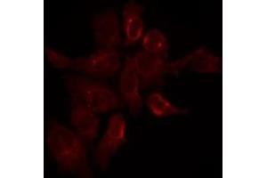 ABIN6275289 staining Hela by IF/ICC. (Nesprin3 抗体  (N-Term))