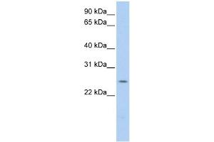 PARK7 antibody used at 1 ug/ml to detect target protein. (PARK7/DJ1 抗体)