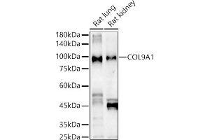 Western blot analysis of extracts of various cell lines, using COL9 Rabbit pAb antibody (ABIN6127648, ABIN6138849, ABIN6138851 and ABIN6222235) at 1:1000 dilution. (COL9A1 抗体  (AA 20-270))