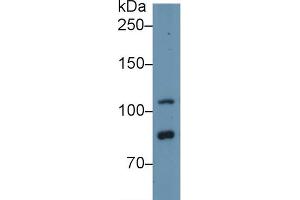 Detection of TLR5 in Human Hela cell lysate using Polyclonal Antibody to Toll Like Receptor 5 (TLR5) (TLR5 抗体  (AA 693-858))