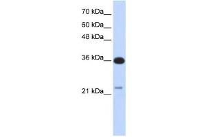 Western Blotting (WB) image for anti-TP53 Target 5 (TP53TG5) antibody (ABIN2459705)