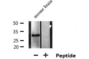 Western blot analysis of extracts from Mouse brain lysate, using MTAP antibody.