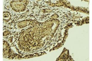 ABIN6269152 at 1/100 staining Mouse colon tissue by IHC-P. (ATF2 抗体  (N-Term))