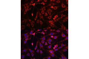 Immunofluorescence (IF) image for anti-3-Hydroxy-3-Methylglutaryl-CoA Reductase (HMGCR) (AA 629-888) antibody (ABIN3022294)