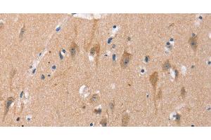 Immunohistochemistry of paraffin-embedded Human brain using OTUB1 Polyclonal Antibody at dilution of 1:40 (OTUB1 抗体)