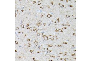 Immunohistochemistry (IHC) image for anti-Glycyl-tRNA Synthetase (GARS) (AA 60-370) antibody (ABIN6140964)