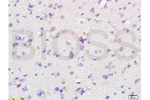 Immunohistochemistry (IHC) image for anti-Macrophage Migration Inhibitory Factor (Glycosylation-Inhibiting Factor) (MIF) (AA 51-115) antibody (ABIN736836)
