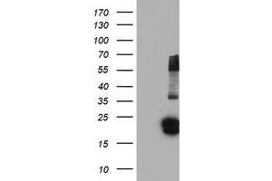 Western Blotting (WB) image for anti-Fibroblast Growth Factor 21 (FGF21) (AA 29-209) antibody (ABIN1491337) (FGF21 抗体  (AA 29-209))