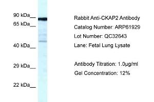Western Blotting (WB) image for anti-Cytoskeleton Associated Protein 2 (CKAP2) (C-Term) antibody (ABIN2788952) (CKAP2 抗体  (C-Term))