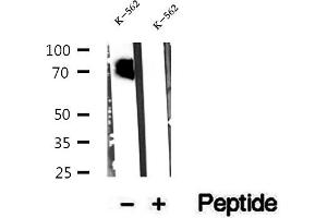 Western blot analysis of extracts of K-562 cells, using CMIP antibody. (CMIP 抗体  (C-Term))