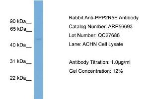 Western Blotting (WB) image for anti-Protein Phosphatase 2, Regulatory Subunit B', epsilon Isoform (PPP2R5E) (N-Term) antibody (ABIN2786846) (PPP2R5E 抗体  (N-Term))