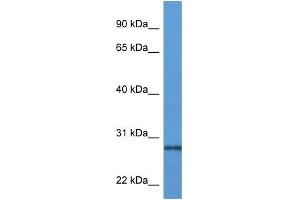 Western Blot showing PRTN3 antibody used at a concentration of 1 ug/ml against Fetal Lung Lysate (PRTN3 抗体  (N-Term))
