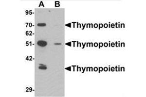 Western blot analysis of Thymopoietin in HeLa cell lysate with Thymopoietin Antibody  at 0.