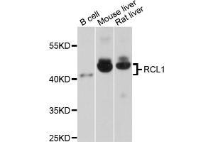 Western blot analysis of extracts of various cell lines, using RCL1 antibody (ABIN1875879) at 1:1000 dilution. (RCL1 抗体)