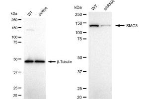 Western blotting analysis using SMC3 antibody (ABIN7800448). (Recombinant SMC3 抗体)