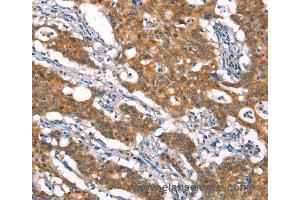 Immunohistochemistry of Human brain  using CYLD Polyclonal Antibody at dilution of 1:35 (CYLD 抗体)