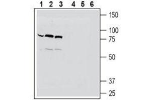Western blot analysis of human THP-1 monocytic leukemia cell line lysates (lanes 1 and 4), mouse BV-2 microglia cell line lysates (lanes 2 and 5) and human HeLa cervix adenocarcinoma cell line lysates (lanes 3 and 6): - 1-3. (SLC22A4 抗体  (C-Term, Intracellular))