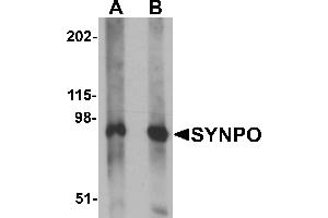 Western Blotting (WB) image for anti-Synaptopodin (SYNPO) (C-Term) antibody (ABIN1030717) (SYNPO 抗体  (C-Term))