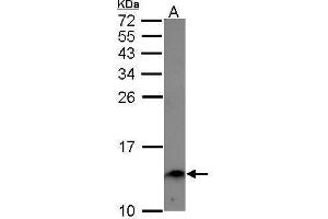 WB Image Sample (30 ug of whole cell lysate) A: A549 15% SDS PAGE antibody diluted at 1:1000 (Ensa 抗体)