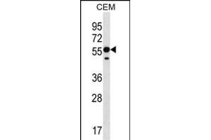 RNF8 Antibody (C-term) (ABIN657354 and ABIN2846404) western blot analysis in CEM cell line lysates (35 μg/lane). (RNF8 抗体  (C-Term))
