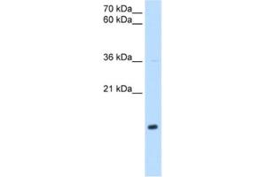 Western Blotting (WB) image for anti-NADH Dehydrogenase (Ubiquinone) 1 beta Subcomplex, 5, 16kDa (NDUFB5) antibody (ABIN2462840) (NDUFB5 抗体)