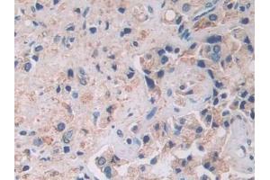 Immunohistochemistry (IHC) image for anti-Ataxin 10 (ATXN10) (AA 116-302) antibody (ABIN7442945)