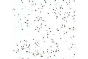Immunocytochemistry (ICC) image for anti-Enhancer of Zeste Homolog 2 (EZH2) (AA 1-154) antibody (ABIN7795766)