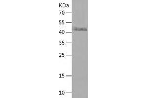 Western Blotting (WB) image for Solute Carrier Family 30 (Zinc Transporter), Member 6 (SLC30A6) (AA 265-461) protein (His-IF2DI Tag) (ABIN7125162) (SLC30A6 Protein (AA 265-461) (His-IF2DI Tag))