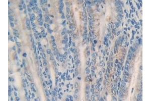 Detection of MGST1 in Mouse Intestine Tissue using Polyclonal Antibody to Microsomal Glutathione S Transferase 1 (MGST1) (MGST1 抗体  (AA 8-155))