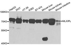 Western blot analysis of extracts of various cell lines, using MLXIPL antibody (ABIN5995539) at 1/1000 dilution. (MLXIPL 抗体)