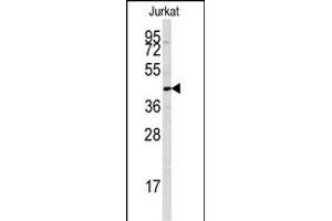 Western blot analysis of anti-PTPN7 Antibody (S44) (ABIN391869 and ABIN2841694) in Jurkat cell line lysates (35 μg/lane). (PTPN7 抗体  (AA 22-51))