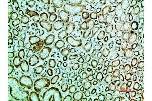 Immunohistochemical analysis of paraffin-embedded human-kidney, antibody was diluted at 1:200 (IRF3 抗体  (AA 1268-1341))